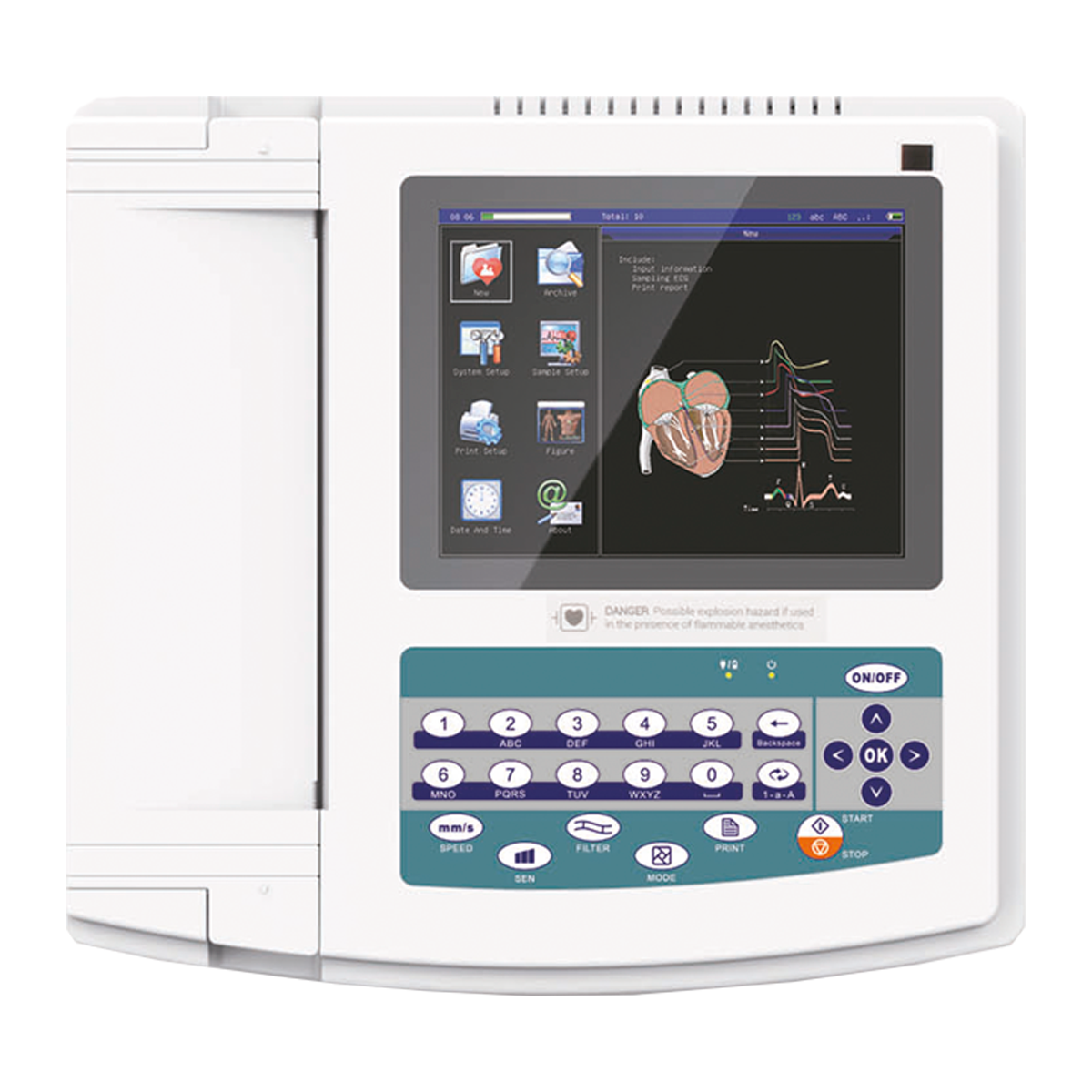 ECG 12 CANALES